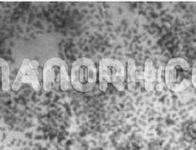 lanthanum trifluoride nanoparticles